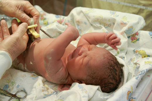 clamping baby's umbilical cord