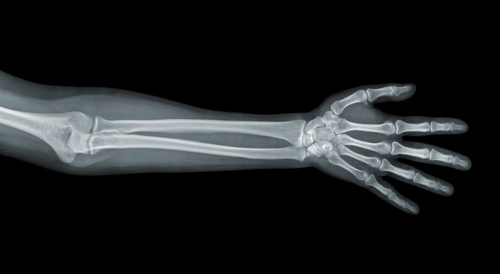 X-ray of a forearm | Nourish Baby