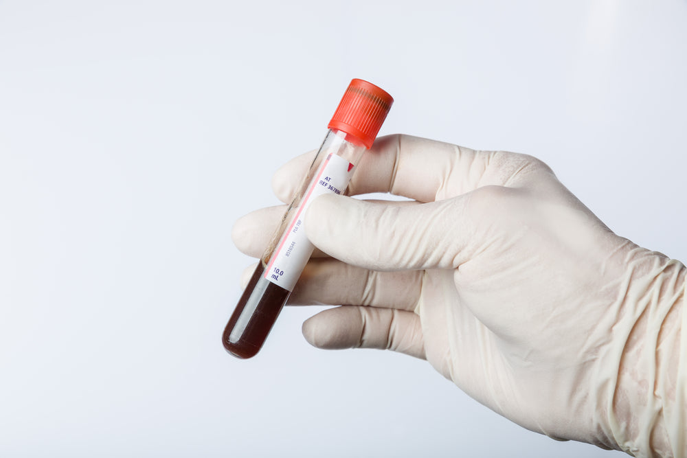 Test tube of blood | Nourish Baby